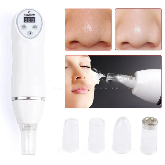 Electric Pore Suction and Acne Remover
